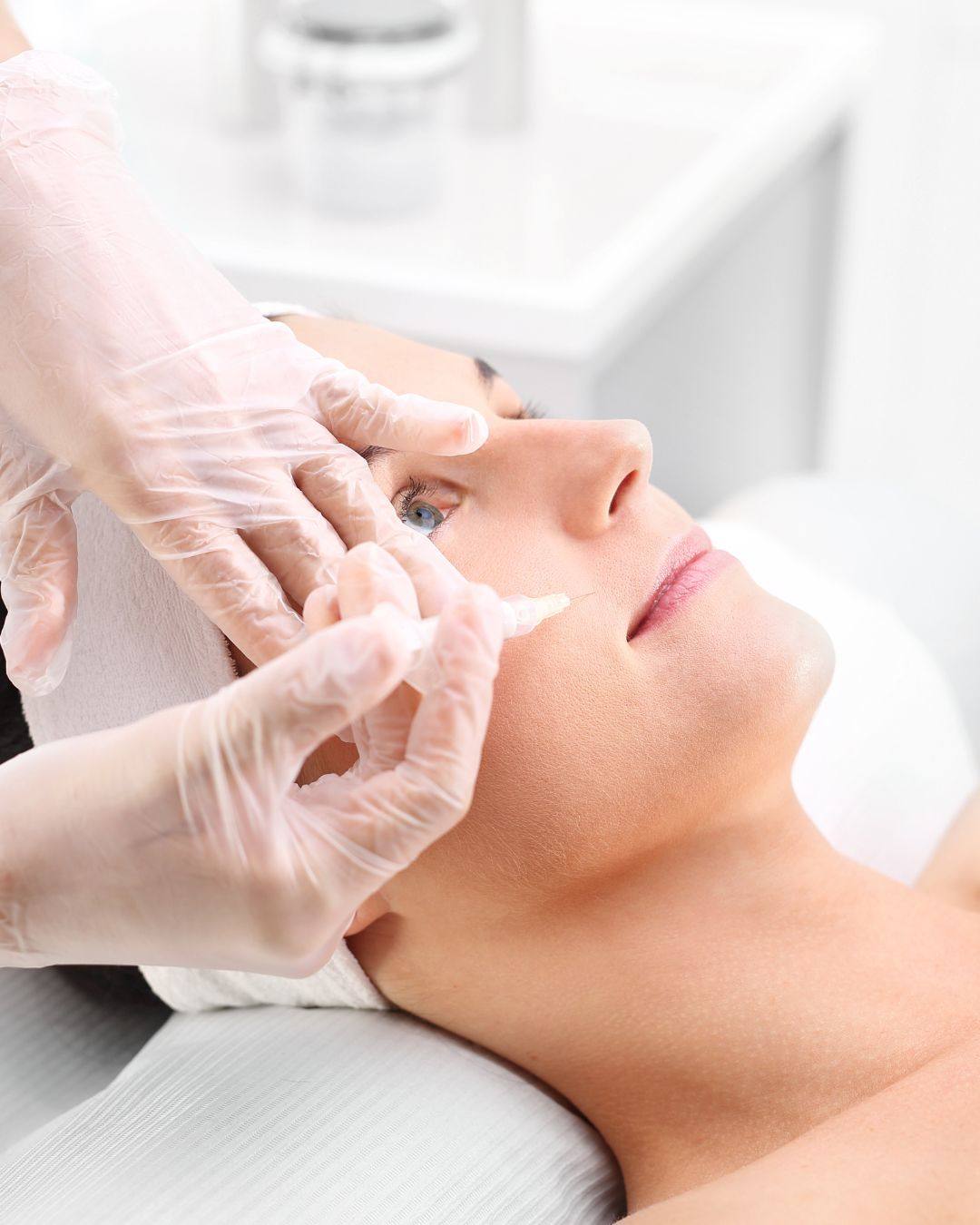 Mesoterapia Facial Con Vitaminas Para Estar Radiante En Todos Los