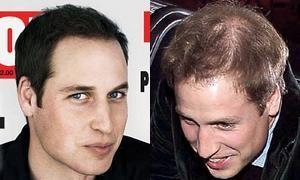 �Photoshop para el Pr�ncipe Guillermo?