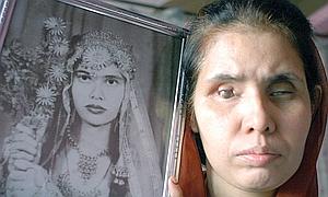 El infierno qu�mico de Bhopal