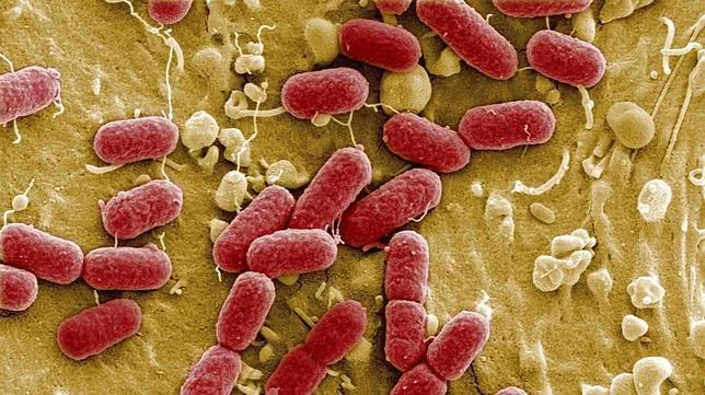Qu es Escherichia coli?: Todas los detalles sobre la bacteria de los pepinos