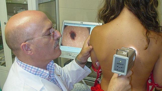 El cáncer de piel, el más frecuente entre los jóvenes El cáncer de piel, el más frecuente entre los jóvenes