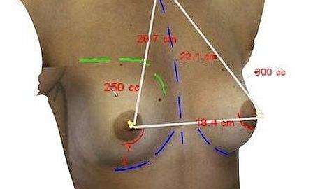 Crean un simulador 3D para ver cómo quedarán con ropa los implantes de pecho Crean un simulador 3D para ver cómo quedarán con ropa los implantes de pecho