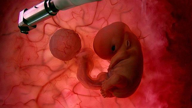 Retrasan un año el entierro de un feto fallecido por varios errores Retrasan un año el entierro de un feto fallecido por varios errores