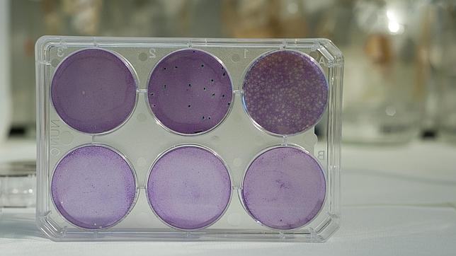 La vacuna espaola contra el VIH logra una respuesta inmune del 90% 