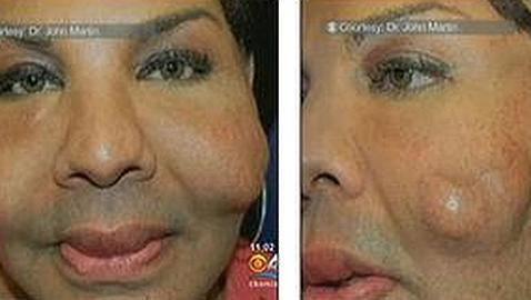 Salen a la luz las primeras v�ctimas de Oneal Ron Morris, la �cirujana del cemento�