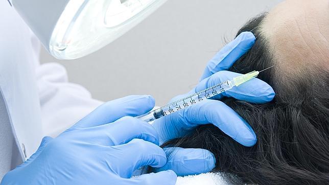 La cada del cabello se puede detener si actuamos a tiempo