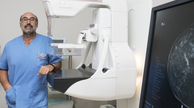 mamografía en Sevilla