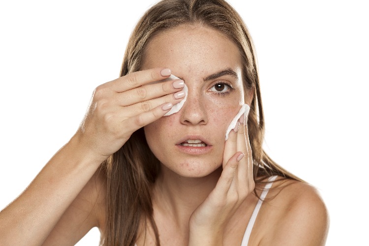 Mujer adulta con acné