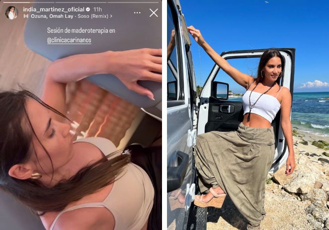 Maderoterapia y cámara hiperbárica: estos son los trucos de India Martínez para el verano