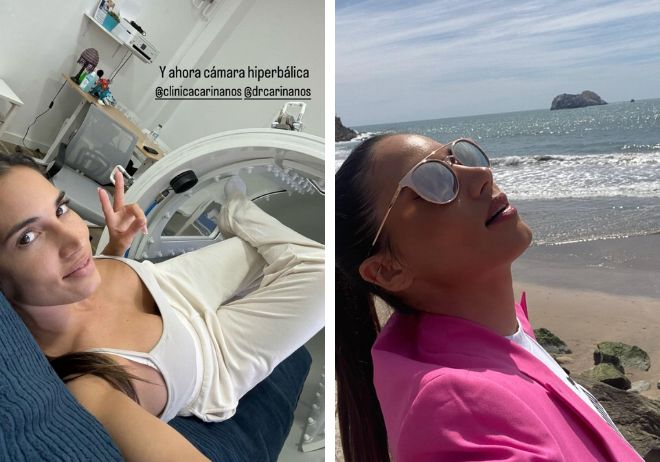 Maderoterapia y cámara hiperbárica: estos son los trucos de India Martínez para el verano