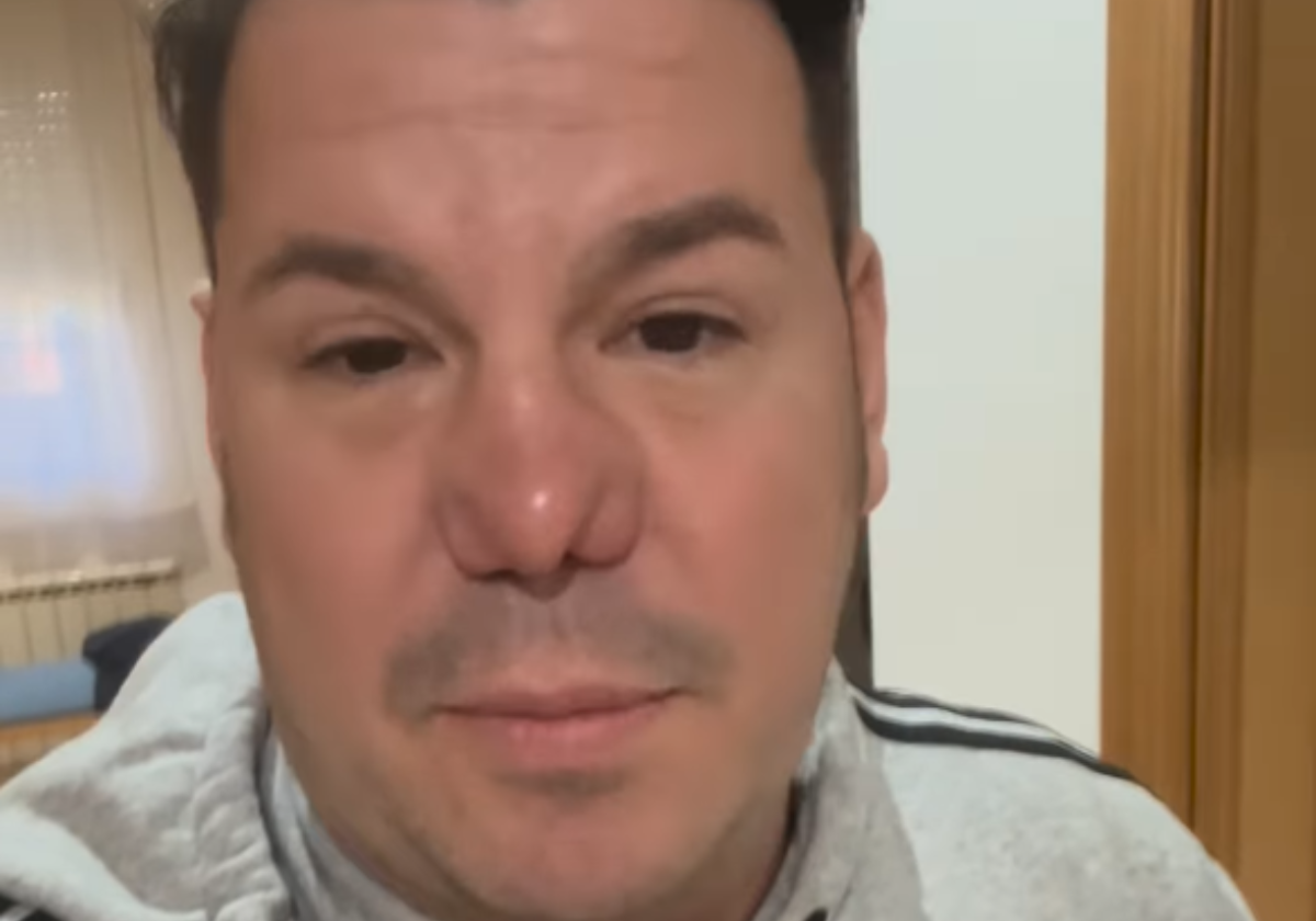 Lucas, de Andy y Lucas, reconoce que mintió sobre su nariz y agradece el apoyo: “Fue por mi derecho a la libertad”