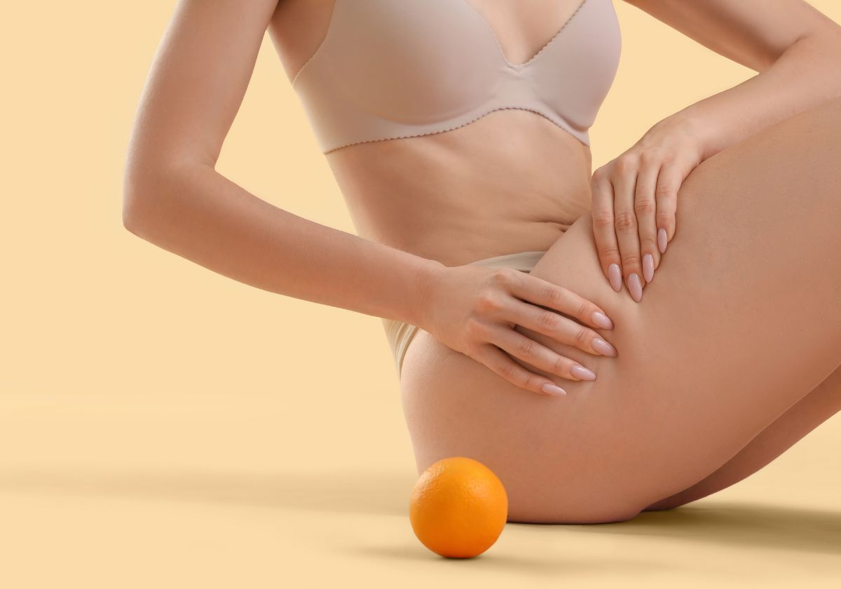 Estos son los consejos esenciales si quieres perder celulitis, según una experta: “No existen soluciones mágicas, la clave es…”