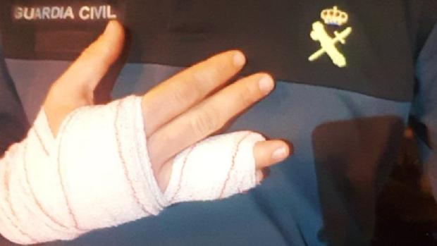 Mano del agente herido en la detención de sujeto