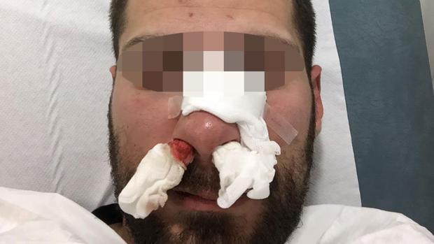 Imagen del policÃa tras la paliza
